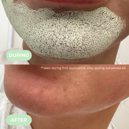 Hyaluronic-Infused Green Tea Clay